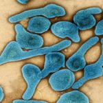 ไวรัสมาร์เบิร์ก ระบาดในอิเควทอเรียลกินี อัตราเสียชีวิตสูง 88%